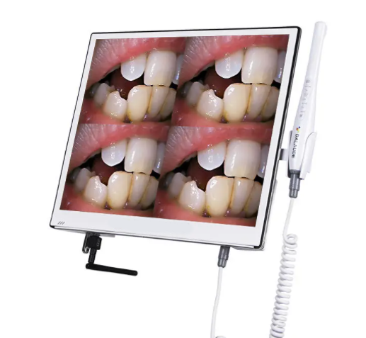 Intraoral camera displaying multiple views of teeth for detailed dental diagnostics and treatment planning